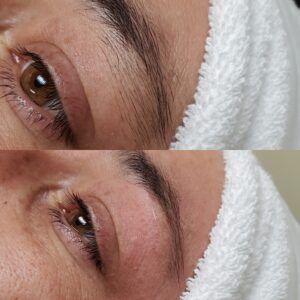 Before/After Brow Wax